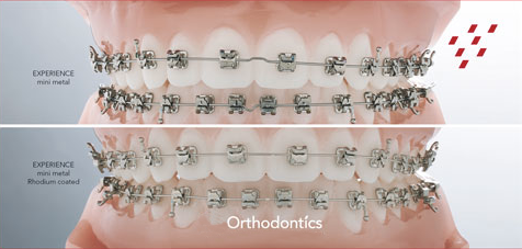 Rhodium Toronto ON, Innovative Orthodontics